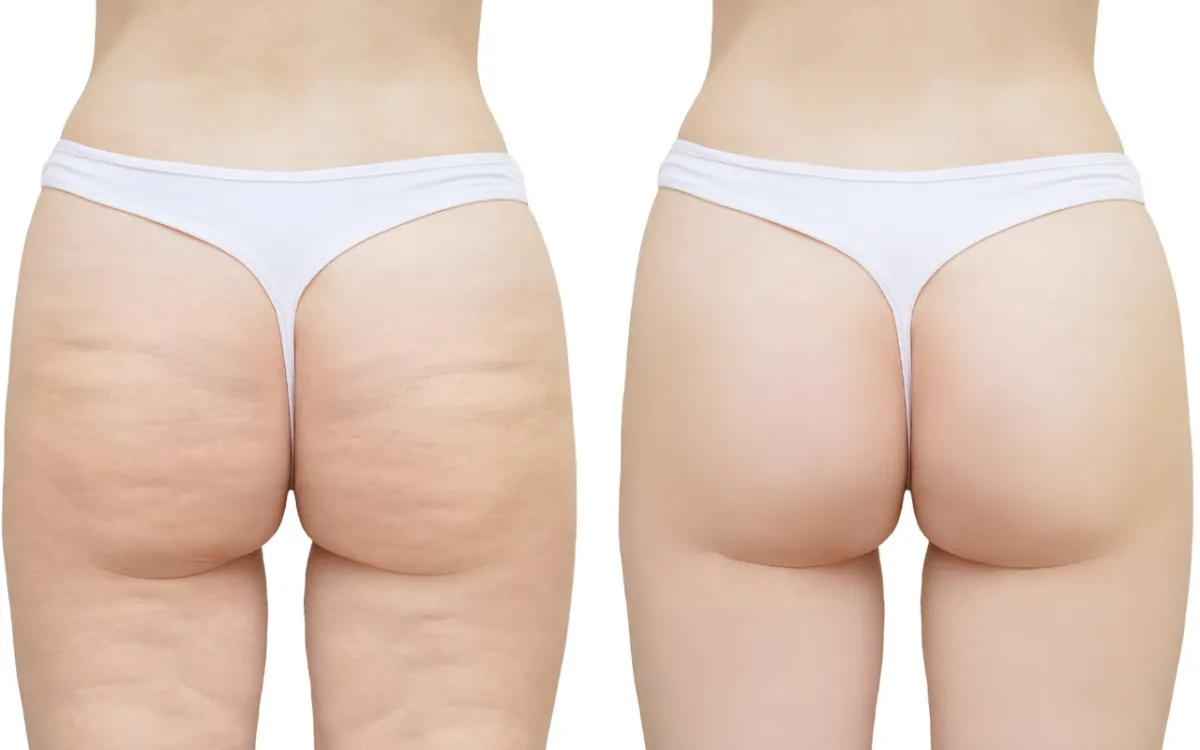 a person posing for the camera